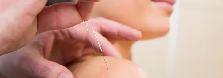 Chiropractic Groton CT Acupuncture