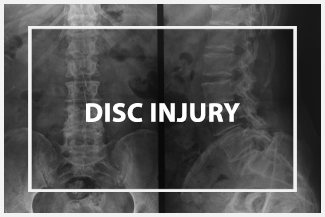 Chiropractic Groton CT Disc Injury All Services